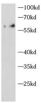 PFKFB3 Rabbit Polyclonal Antibody
