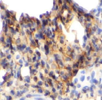 PFKFB3 Rabbit Polyclonal Antibody