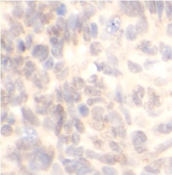 CAV1 Antibody
