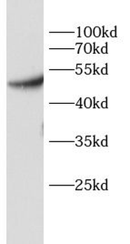 PDK1 Rabbit Polyclonal Antibody