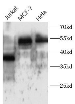 ATF4 Rabbit Polyclonal Antibody