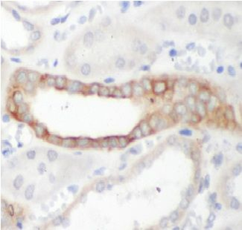ATF4 Rabbit Polyclonal Antibody
