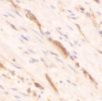 GREM1 Antibody