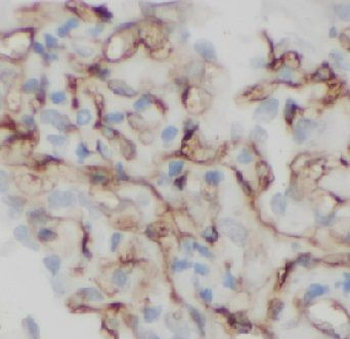 CD34 Rabbit Polyclonal Antibody