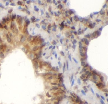 ATP5F1A Antibody