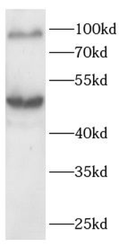 ATF6 Rabbit Polyclonal Antibody
