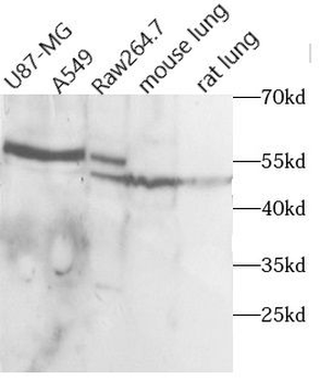 CD14 Rabbit Polyclonal Antibody