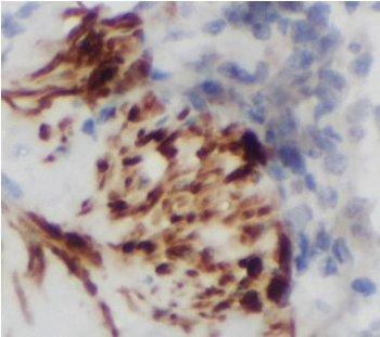 CTCFL Antibody