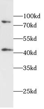 AR Rabbit Polyclonal Antibody