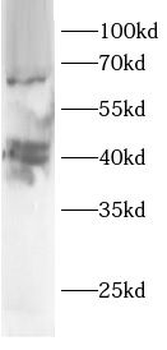 ARL13B Antibody