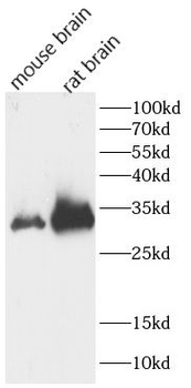 CALB2 Rabbit Polyclonal Antibody
