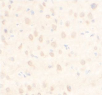ARPC5L Antibody