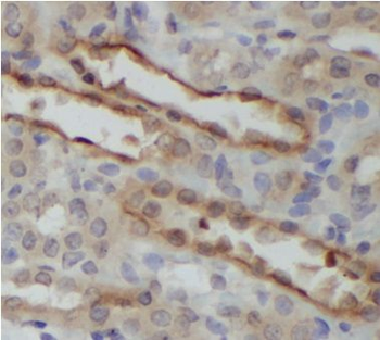 RAF1 Rabbit Polyclonal Antibody