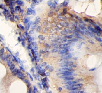 CHM Antibody
