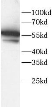 ALPL Rabbit Polyclonal Antibody