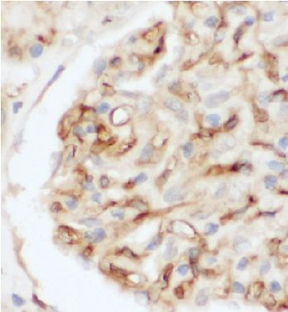 ALPL Rabbit Polyclonal Antibody