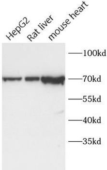CPT2 Rabbit Polyclonal Antibody