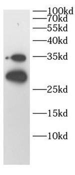TIGAR Antibody