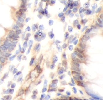 TIGAR Antibody