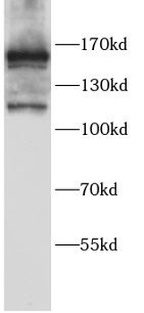 MSH6 Rabbit Polyclonal Antibody