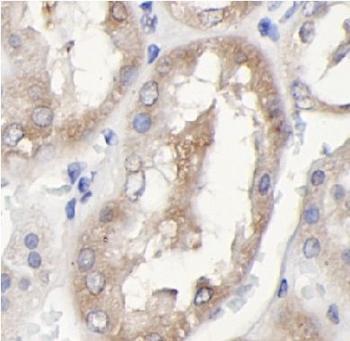 SUPT6H Rabbit Polyclonal Antibody