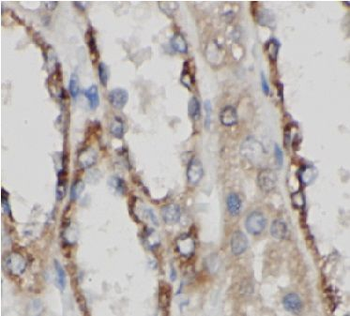 AP2M1 Antibody