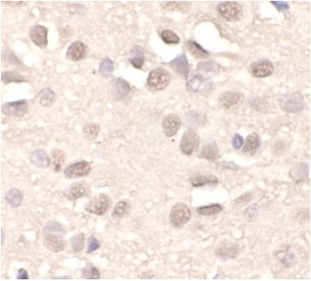 APTX Antibody