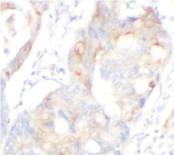 HK3 Rabbit Polyclonal Antibody