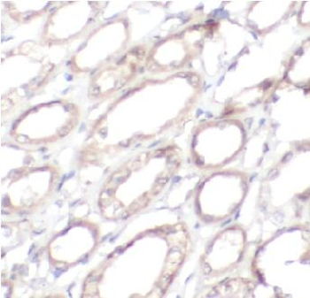 RHEB Antibody