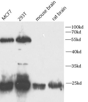 EIF4E Rabbit Polyclonal Antibody