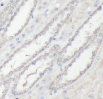 EIF4E Rabbit Polyclonal Antibody