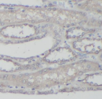 ABCC6 Antibody