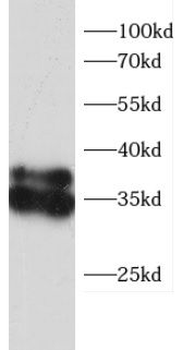 CD74 Rabbit Polyclonal Antibody