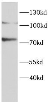 LIPE Rabbit Polyclonal Antibody