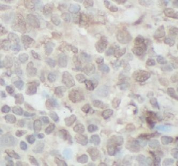 LIPE Rabbit Polyclonal Antibody