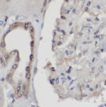 HIF1A Rabbit Polyclonal Antibody
