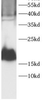 EIF4EBP1 Rabbit Polyclonal Antibody