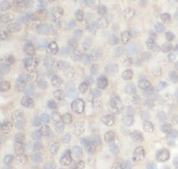 EIF4EBP1 Rabbit Polyclonal Antibody