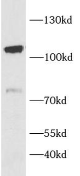 SIK2 Rabbit Polyclonal Antibody