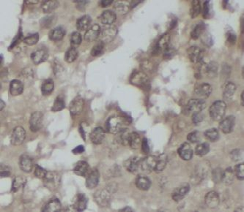 CITED2 Antibody