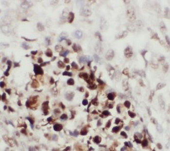 ITCH Antibody