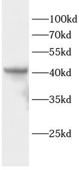 CSNK2A1 Antibody