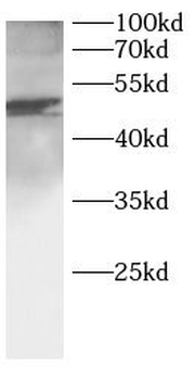 IKBKG Rabbit Polyclonal Antibody