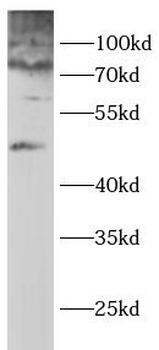 GYS2 Rabbit Polyclonal Antibody
