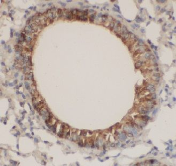 PRKCH Antibody