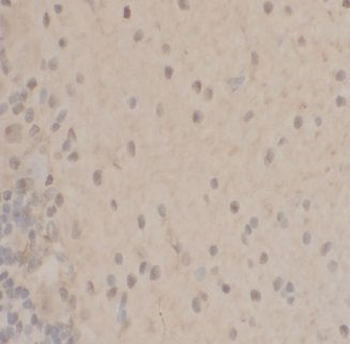PPP1CA Antibody