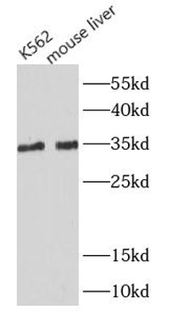 MYD88 Rabbit Polyclonal Antibody