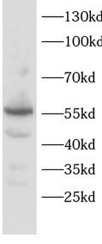 PTGIS Rabbit Polyclonal Antibody