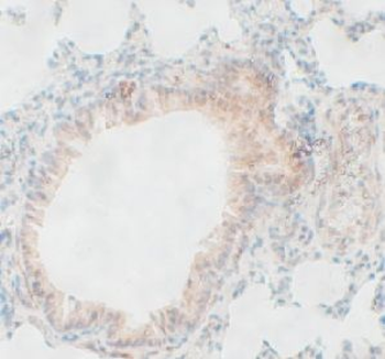 PTGIS Rabbit Polyclonal Antibody