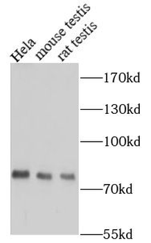 ERCC2 Rabbit Polyclonal Antibody